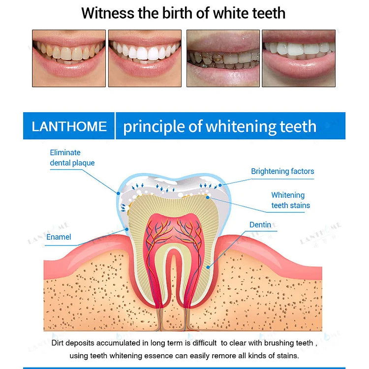 TeethWhip™ - Essenz Zur Zahnaufhellung (50% RABATT)
