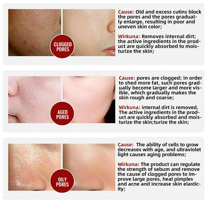 (1+1 Gratis) FreshSkin™ Pore Invisible Cream l Pflege deine Haut!