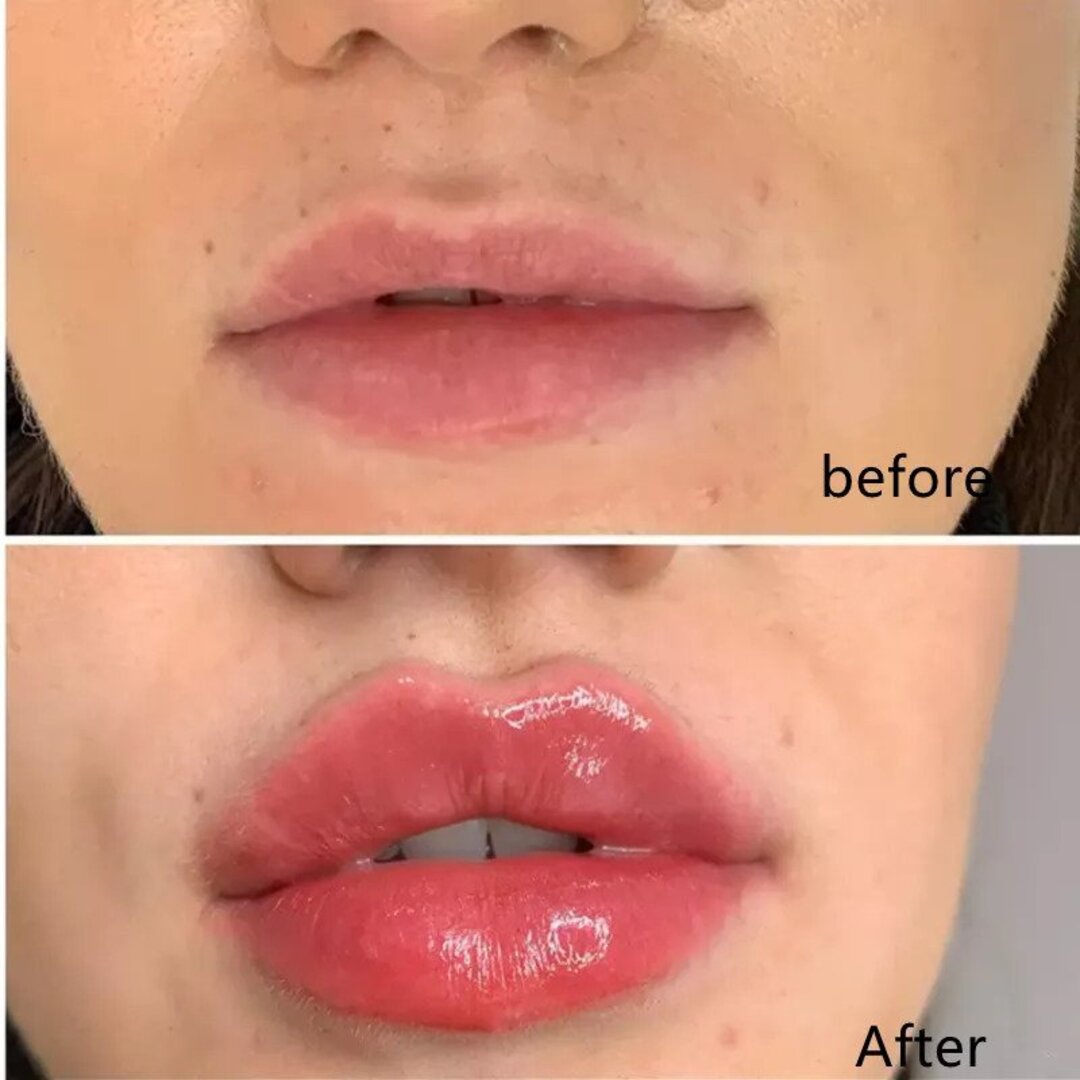 1+1 GRATIS | LipMaximizer™️ | Perfektes Lippen Serum