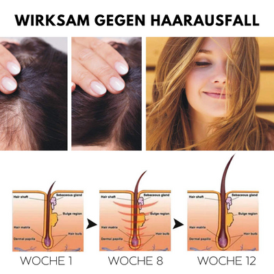 1+1 GRATIS | HairRegrow™ | Haarwachstumsspray
